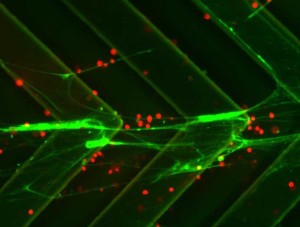 A new device inspired by jellyfish tentacles can be used to both count and sort cancer cells, which is an important indicator of how well chemotherapy or other treatments are working. Source: Rohit Karnik and Suman Bose