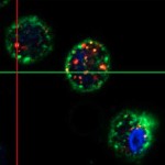 Intracellular Particles