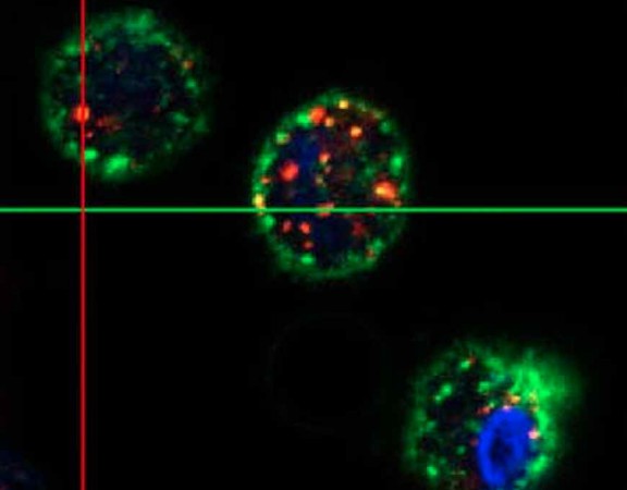 Intracellular Particles